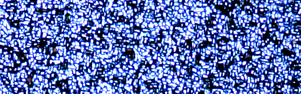 明美金相显微镜MJ42视野下的斑斓世界