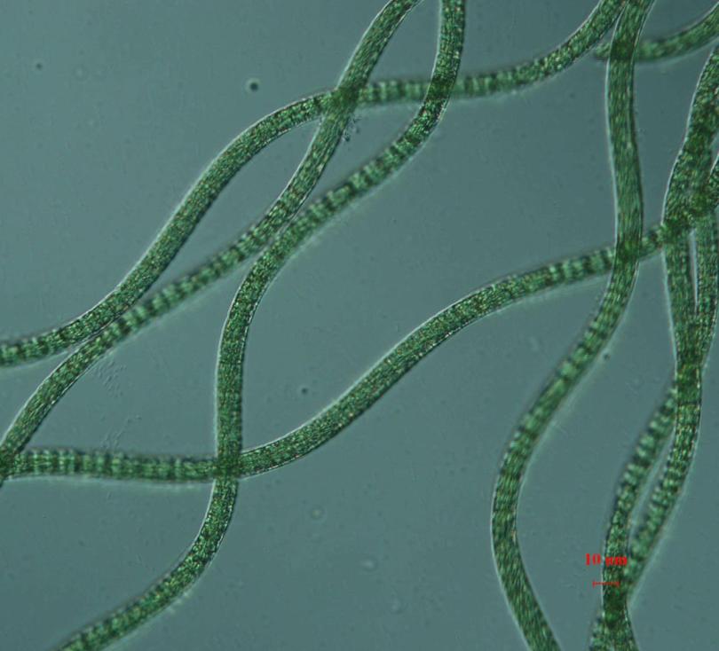 蒲柘倒置生物显微镜下的螺旋藻